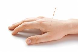 Implant Acupuncture طب سوزنی ایمپلنت
