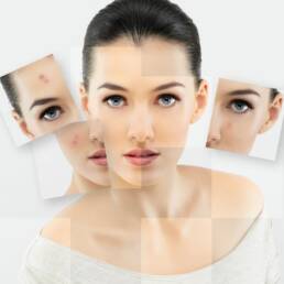 facial rejuvenation جوانسازی پوست صورت