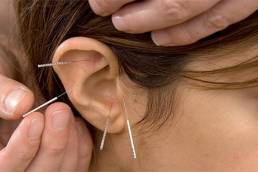 ترک اعتیاد با طب سوزنی گوش Drug addiction by ear acupuncture