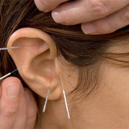 ترک اعتیاد با طب سوزنی گوش Drug addiction by ear acupuncture