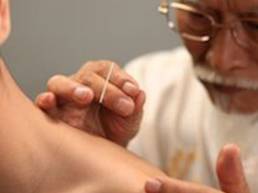 points targets acupuncture نقاط طب سوزنی