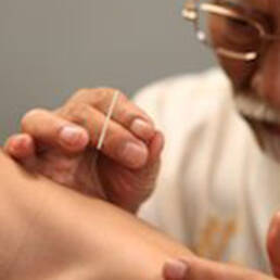 points targets acupuncture نقاط طب سوزنی
