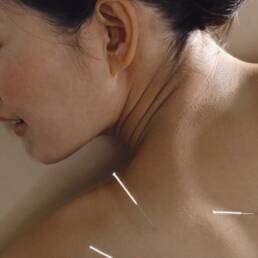 طب سوزنی فشار درمانی Acupuncture vs Acupressure