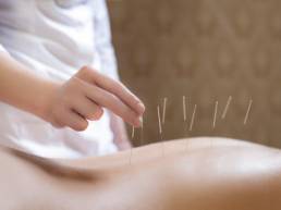 طب سوزنی درمان دیسک گردن Effects of Acupuncture on Cervical Disc Treatment