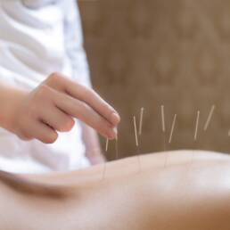 طب سوزنی درمان دیسک گردن Effects of Acupuncture on Cervical Disc Treatment